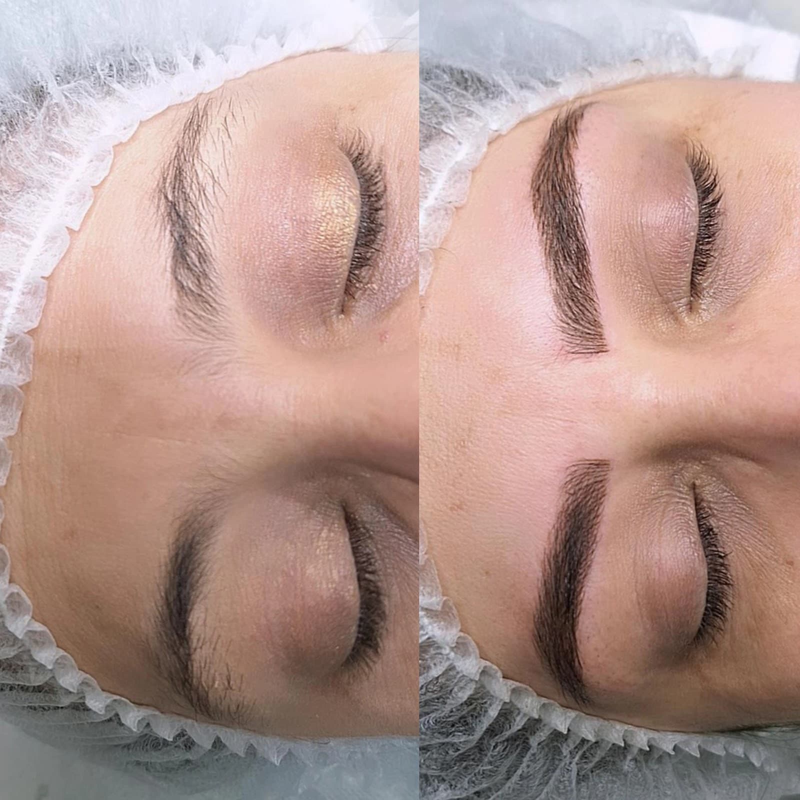 Equipo de valoración facial en cabina